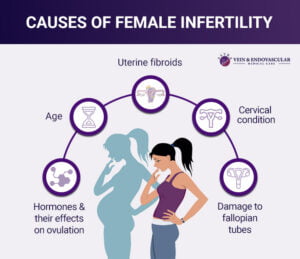 Infertility Treatment - Vein & Endovascular Medical Care