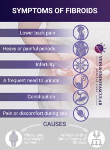 Fibroid Symptoms - Vein & Endovascular Medical Care