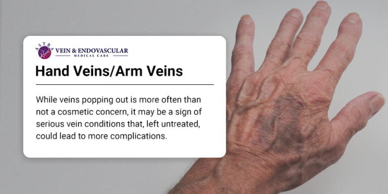 visible-hand-veins-and-why-you-have-them-vein-endovascular-medical