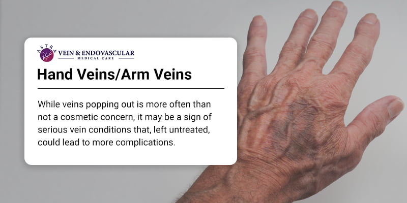 Visible Hand Veins And Why You Have Them Vein Endovascular Medical 